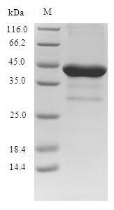 Human Neurotrophic factor BDNF precursor form (BDNF), partial Recombinant Protein, Homo sapiens (Human), E.coli, N-terminal GST-tagged, 38.5 kDa, purity >≥ 90% as determined by SDS-PAGE.