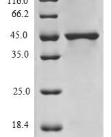 Human Histone H3.3 (H3F3A), partial Recombinant Protein, N-GST - BioCrest Sci