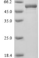 Human Phosphatidylinositol 5-phosphate 4-kinase type-2 beta (PIP4K2B) Recombinant Protein - BioCrest Sci