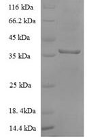 Escherichia coli Malate dehydrogenase (mdh) Recombinant Protein - BioCrest Sci