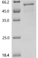Human Fibroblast growth factor 10(FGF10), partial Recombinant Protein - BioCrest Sci