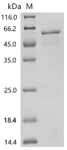 Human Fibroblast growth factor 10(FGF10), partial Recombinant Protein, Homo sapiens (Human), E.coli, C-terminal GST-tagged, 50.9 kDa, purity >≥ 85% as determined by SDS-PAGE.