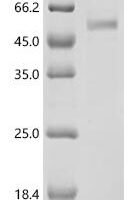 Human CMRF35-like molecule 1 (CD300LF) (E111A,D116A,W52A,W59A), partial Recombinant Protein - BioCrest Sci