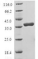 Human Late cornified envelope-like proline-rich protein 1 (LELP1) Recombinant Protein - BioCrest Sci