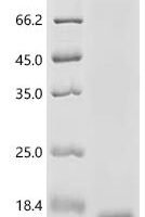 Mouse Mas-related G-protein coupled receptor member B2 (Mrgprb2), partial Recombinant Protein, N-His-SUMOstar - BioCrest Sci