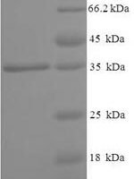 Human N (4)- (beta-N-acetylglucosaminyl)-L-asparaginase (AGA), partial Recombinant Protein, N-His-SUMO, aa 24–205 - BioCrest Sci