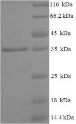 Human N (4)- (beta-N-acetylglucosaminyl)-L-asparaginase (AGA), partial Recombinant Protein, N-His-SUMO, aa 24–205, Homo sapiens (Human), E.coli, N-terminal 6xHis-SUMO-tagged, 35.6 kDa, purity >≥ 90% as determined by SDS-PAGE.