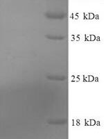 Mouse Serum amyloid A-3 protein (Saa3), partial Recombinant Protein, N-His, aa 20–122, Yeast - BioCrest Sci