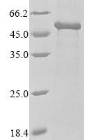 Human Pyruvate dehydrogenase E1 component subunit alpha, somatic form, mitochondrial (PDHA1), partial Recombinant Protein, N-10His/C-Myc - BioCrest Sci