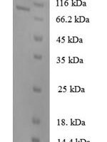 Human N-acetylgalactosamine-6-sulfatase (GALNS) Recombinant Protein, N-GST - BioCrest Sci