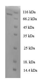 Human N-acetylgalactosamine-6-sulfatase (GALNS) Recombinant Protein, N-GST, Homo sapiens (Human), E.coli, N-terminal GST-tagged, 82.4 kDa, purity >≥ 90% as determined by SDS-PAGE.