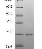 Human cysteine-rich tail protein 1 (CYSRT1) Recombinant Protein - BioCrest Sci