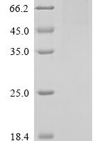 Human Vascular endothelial growth factor receptor 1 (FLT1), partial,Biotinylated Recombinant Protein - BioCrest Sci