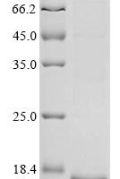 Feline coronavirus Spike glycoprotein (S), partial Recombinant Protein - BioCrest Sci