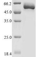 Rat E3 ubiquitin-protein ligase parkin (Prkn) Recombinant Protein - BioCrest Sci