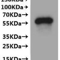 Human Transmembrane 9 superfamily member 1 (TM9SF1)-VLPs Recombinant Protein - BioCrest Sci