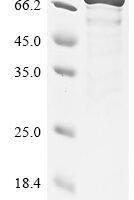 Mouse Wee1-like protein kinase (Wee1) Recombinant Protein - BioCrest Sci
