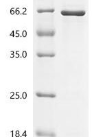 Human Sestrin-2 (SESN2) Recombinant Protein - BioCrest Sci