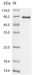 Human Sestrin-2 (SESN2) Recombinant Protein, Homo sapiens (Human), E.coli, C-terminal 6xHis-tagged, 61.4 kDa, purity >≥ 85% as determined by SDS-PAGE.