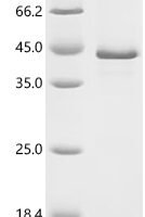 Human Proto-oncogene Wnt-1 (WNT1) Recombinant Protein - BioCrest Sci