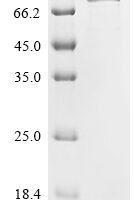 Human Cadherin-10 (CDH10), partial Recombinant Protein - BioCrest Sci