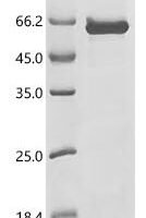 Bunyavirus snowshoe hare Envelope glycoprotein (GP), partial Recombinant Protein - BioCrest Sci