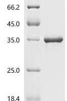 Orthopoxvirus vaccinia Cell surface-binding protein OPG105 (D8L), partial Recombinant Protein, N-His - BioCrest Sci