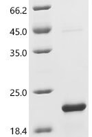 Human CCL5/RANTES Recombinant Protein, N-His/C-His - BioCrest Sci