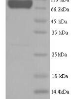 Human E3 ubiquitin-protein ligase SMURF2 (SMURF2) Recombinant Protein - BioCrest Sci