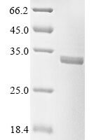 Human Mitochondrial cardiolipin hydrolase (PLD6) Recombinant Protein, Tag-Free - BioCrest Sci