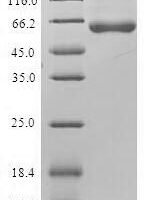 Human Gamma-soluble NSF attachment protein (NAPG) Recombinant Protein - BioCrest Sci