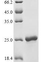 Mycobacterium bovis Cell surface glycolipoprotein MPB83 (mpb83) Recombinant Protein - BioCrest Sci