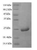 Centruroides noxius Beta-mammal toxin Cn2 Recombinant Protein - BioCrest Sci