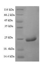 Centruroides noxius Beta-mammal toxin Cn2 Recombinant Protein, Centruroides noxius (Mexican scorpion), E.coli, N-terminal 6xHis-SUMO-tagged, 23.6 kDa, purity >≥ 90% as determined by SDS-PAGE.