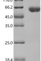 Dog Programmed Cell Death Protein 1 precursor, partial,Biotinylated Recombinant Protein - BioCrest Sci