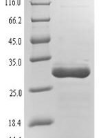 Epstein-Barr virus Envelope glycoprotein L (gL) Recombinant Protein, N-His-SUMO - BioCrest Sci