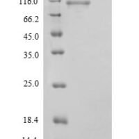 Human Signal transducer and activator of transcription 3 (STAT3) Recombinant Protein - BioCrest Sci