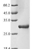 Human respiratory syncytial virus B Matrix M2-1 (M2-1) Recombinant Protein - BioCrest Sci