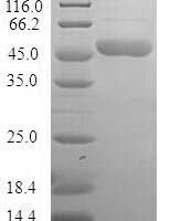 Human BAG family molecular chaperone regulator 2 (BAG2) Recombinant Protein - BioCrest Sci