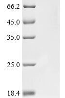 Human Signal transducer and activator of transcription 3 (STAT3),Biotinylated Recombinant Protein - BioCrest Sci