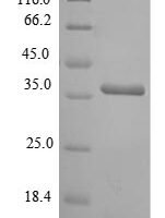 Rat Galectin-4 (Lgals4) Recombinant Protein - BioCrest Sci