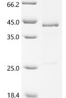 Mouse Secreted frizzled-related protein 5 (Sfrp5) Recombinant Protein, C-His - BioCrest Sci