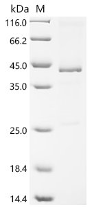 Mouse Secreted frizzled-related protein 5 (Sfrp5) Recombinant Protein, C-His, Mus musculus (Mouse), E.coli, C-terminal 6xHis-tagged, 40.1 kDa, purity >≥ 85% as determined by SDS-PAGE.