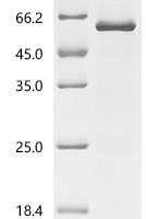 Human Elongation factor 1-alpha 1 (EEF1A1)(C31A) Recombinant Protein, C-His - BioCrest Sci