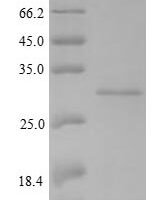 Klebsiella oxytoca Carbapenem-hydrolyzing beta-lactamase KPC (bla) Recombinant Protein, N-His - BioCrest Sci
