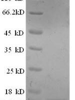Sheep Interleukin-8 (IL8) Recombinant Protein - BioCrest Sci