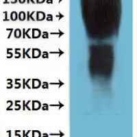 Human Type-2 angiotensin II receptor (AGTR2)-VLPs Recombinant Protein - BioCrest Sci