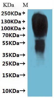 Human Type-2 angiotensin II receptor (AGTR2)-VLPs Recombinant Protein, Homo sapiens (Human), Mammalian cell, C-terminal 10xHis-tagged(This tag can be tested only under denaturing conditions), 42.6 kDa, purity >≥ 95% as determined by SEC-HPLC.