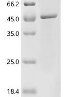 Bacteroides gingivalis Major fimbrial subunit protein type-2 (fimA) Recombinant Protein - BioCrest Sci