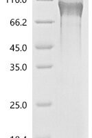Human Tumor necrosis factor receptor superfamily member 8(TNFRSF8), partial Recombinant Protein - BioCrest Sci